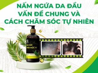 ITCH SCALP FUNGUS AND NATURAL CARE