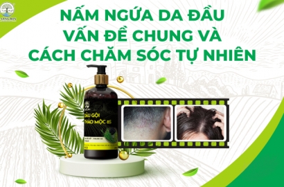 ITCH SCALP FUNGUS AND NATURAL CARE